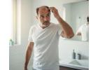 Revitalize Your Look with Expert Hair Restoration for Men in Los Angeles