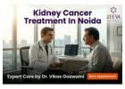 Kidney Cancer Treatment In Noida | Patient-Centered Care
